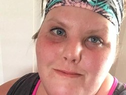 Kelainan Genetik, Wanita Ini Terus Merasa Lapar Meski Sudah Banyak Makan