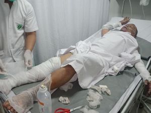 Foto: Kondisi Korban Ledakan Tabung Gas Kampung Melayu Foto: Kondisi Korban Ledakan Tabung Gas Kampung Melayu