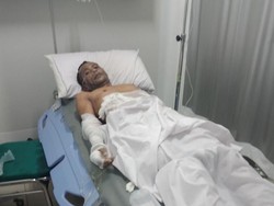 Begini Kondisi Korban Ledakan Tabung Gas di Kampung Melayu