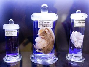 Foto: Museum Parasit di Tokyo yang Bikin Merinding