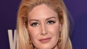 10 Artis yang Ketahuan Operasi Hidung, Jadi Makin Mancung