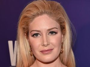 10 Artis yang Ketahuan Operasi Hidung, Jadi Makin Mancung