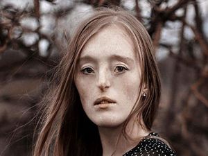 Tersentuh Foto-foto Indah Wanita yang Terlahir dengan Bibir Sumbing Tersentuh Foto-foto Indah Wanita yang Terlahir dengan Bibir Sumbing