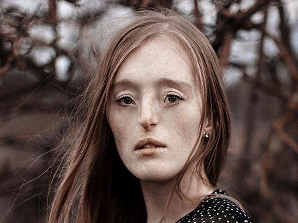 Tersentuh Foto-foto Indah Wanita yang Terlahir dengan Bibir Sumbing Tersentuh Foto-foto Indah Wanita yang Terlahir dengan Bibir Sumbing