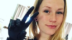 10 Potret Para Pemakai Tangan Bionik Keren!
