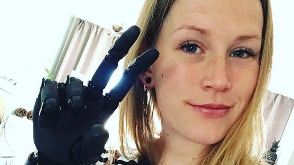 10 Potret Para Pemakai Tangan Bionik Keren!