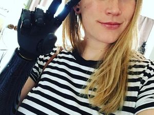 10 Potret Para Pemakai Tangan Bionik Keren! 10 Potret Para Pemakai Tangan Bionik Keren!