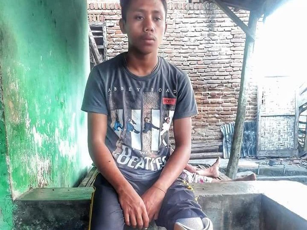 Idris yang Semangat Sekolah Meski Berkaki Satu Idris yang Semangat Sekolah Meski Berkaki Satu