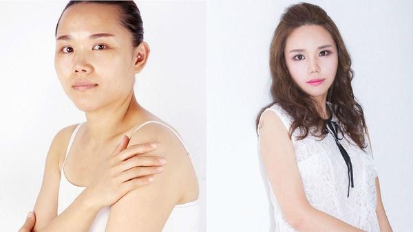 Transformasi 12 Pasien Pasca Operasi Plastik, Bikin Terbengong-bengong