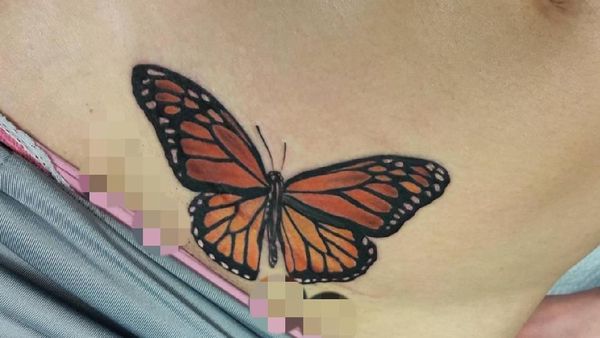 Cantiknya Bekas Operasi Caesar Ini