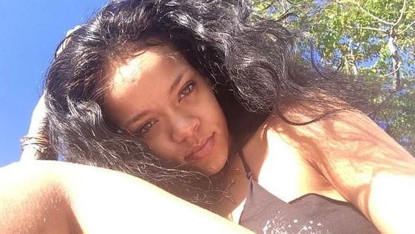 Foto: Bulu Kaki Rihanna yang Bikin Netizen Gagal Fokus 
