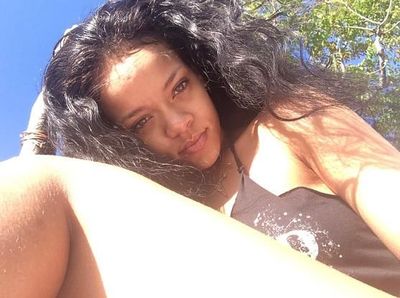 Foto: Bulu Kaki Rihanna yang Bikin Netizen Gagal Fokus 