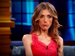 Berat Badan Cuma 34 Kg, Wanita Ini Menikmati Rasanya Kelaparan