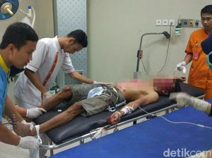Pencuri Motor yang Dihajar Warga di Pasuruan Akhirnya Meninggal