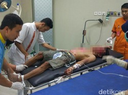 Pencuri Motor yang Dihajar Warga di Pasuruan Akhirnya Meninggal