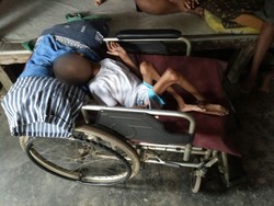 Terbaring Sejak Lahir, Remaja di Sumut Ini Butuh Bantuan