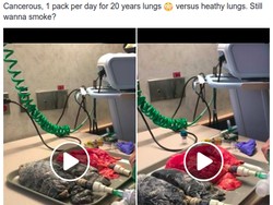 Video Viral Ini Tunjukkan Dampak 20 Tahun Merokok Pada Paru-paru