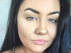 Ngeri! Pakai Krim Tanning Palsu, Kulit Wanita Ini Jadi Mirip Buto Ijo