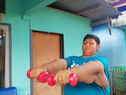 Harapan Orang Tua Bocah Tergemuk Sedunia: Ingin Aria Seperti Anak-anak Lainnya