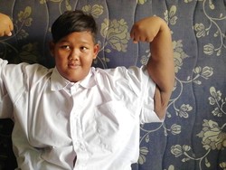 Cerita Aria si Bocah Tergemuk dan Tawaran Operasi Gratis di Jepang