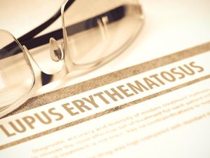 Dokter: Penyakit Lupus Bisa Menyerang dari Ujung Rambut Hingga Kaki
