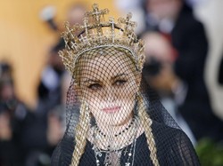 Perkembangan Terbaru Kondisi Madonna Setelah Tak Sadarkan Diri