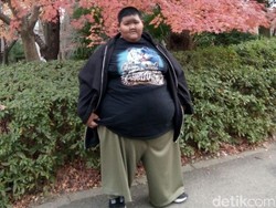 Video: Cerita Bocah Tergemuk Dapat Tawaran Operasi di Jepang