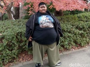 Video: Cerita Bocah Tergemuk Dapat Tawaran Operasi di Jepang Video: Cerita Bocah Tergemuk Dapat Tawaran Operasi di Jepang