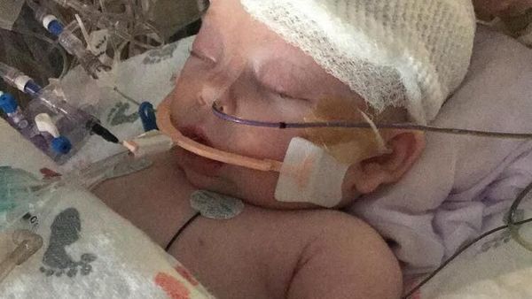 Foto: Tulang Tengkorak Bayi 7 Minggu Ini Patah Terkena Bola Sofbol