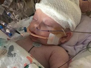 Foto: Tulang Tengkorak Bayi 7 Minggu Ini Patah Terkena Bola Sofbol