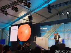 Canggih! Kecerdasan Buatan Google Bisa Cegah Kebutaan