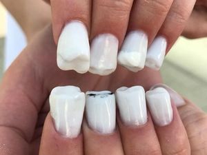 Yay or Nay? Hiasan Kuku Bentuk Gigi yang Bikin Merinding Melihatnya