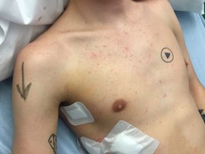 Gara-gara Tato Ini, Dokter Nyaris Salah Iris Saat Mau Operasi