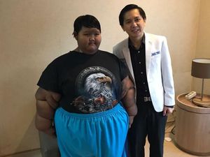 Video: Bariatric Surgery, Operasi yang Memangkas Bobot Bocah Tergemuk Video: Bariatric Surgery, Operasi yang Memangkas Bobot Bocah Tergemuk