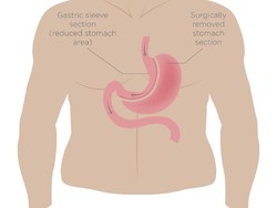 Seperti Apa Proses Pencernaan Makanan di dalam Tubuh? Yuk Simak!