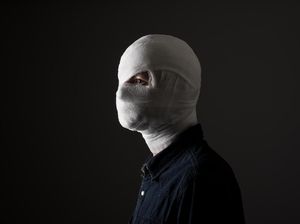 Menkes Sebut Korban Bom Surabaya Luka Bakar 90 Persen, Apa Artinya?