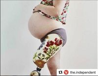 Ada Semangat Membara di Balik Foto Hamil Ibu dengan Satu Kaki/