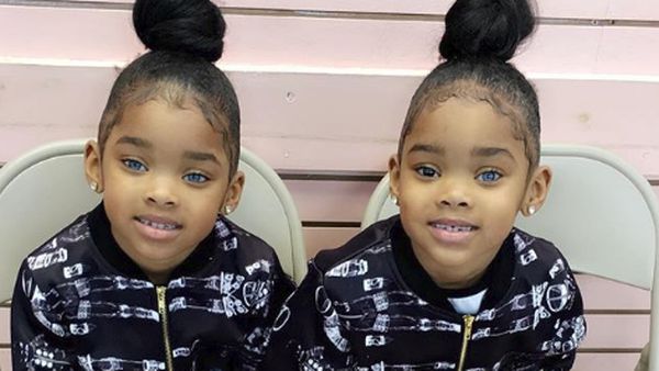 Cantik! Potret si Kembar Bermata Indah