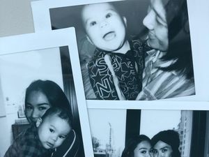 Adara Taista Idap Kanker Melanoma, Tahi Lalat Seperti Ini Perlu Dicurigai Adara Taista Idap Kanker Melanoma, Tahi Lalat Seperti Ini Perlu Dicurigai