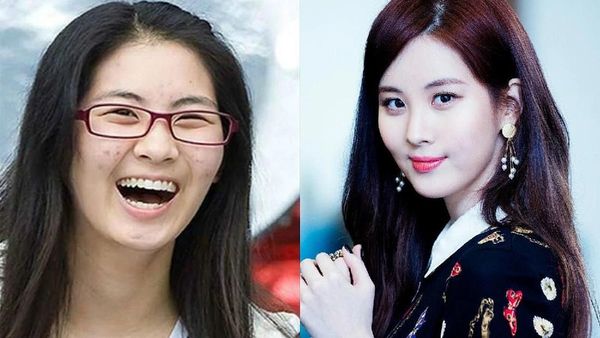 Foto: 10 Idol Korea Ini Kulit Wajahnya Pernah Rusak karena Makeup