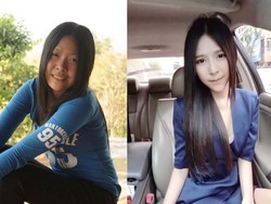 Diet dan Oplas, Perubahan Wanita yang Dicampakkan Pacar Ini Bikin Melongo