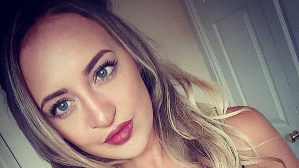 Penampilan Cantik Wanita yang Oplas Pasca Di-bully Karena Bibir Sumbing