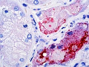 Selain Virus Nipah, Ini Sederet Penyakit yang Dikhawatirkan Jadi Pandemi Baru Selain Virus Nipah, Ini Sederet Penyakit yang Dikhawatirkan Jadi Pandemi Baru