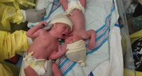 Bayi Ini Langsung Berhenti Menangis Saat Dekat Saudara Kembarnya