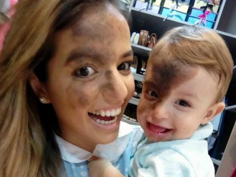Kisah Ibu Hitamkan Wajahnya Demi Membuat si Kecil Percaya Diri 
