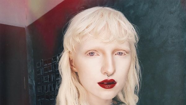 Pesona 11 Model Albino yang Mendobrak Industri Fashion