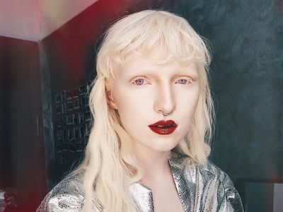 Pesona 11 Model Albino yang Mendobrak Industri Fashion