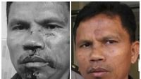 Before After Wajah Hitler yang Dikeroyok Gegara Pesawat Pengintai