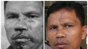 Before After Wajah Hitler yang Dikeroyok Gegara Pesawat Pengintai
