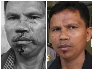 Before After Wajah Hitler yang Dikeroyok Gegara Pesawat Pengintai Before After Wajah Hitler yang Dikeroyok Gegara Pesawat Pengintai